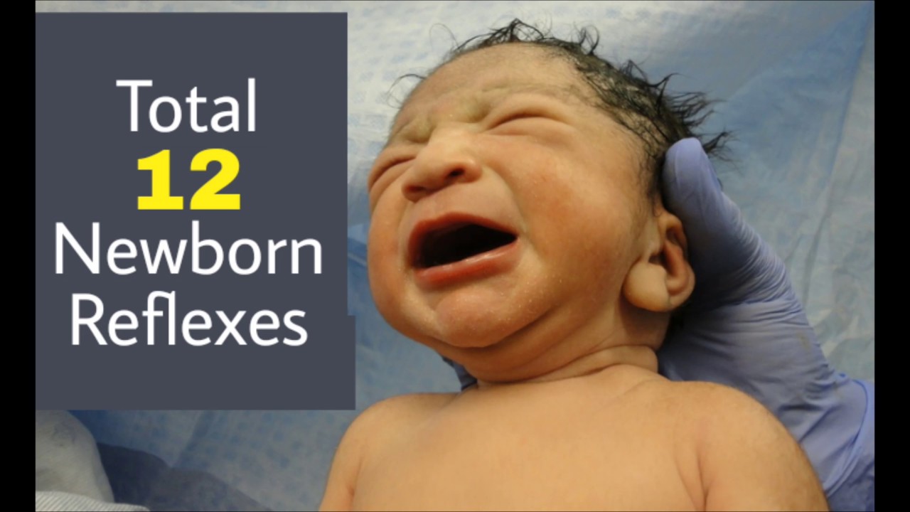 Newborn Reflexes I Neonatal Reflexes - YouTube