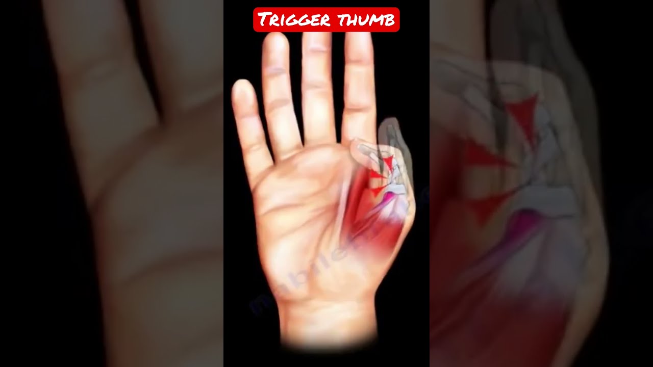 Trigger Thumb Shorts