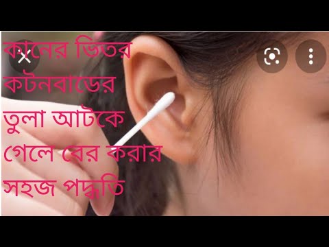 কানের ভিতর কটনবাডের তুলা  বের করার সহজ উপায়