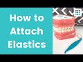HOW TO PUT ELASTICS ON CLEAR ALIGNERS l Dr. Bailey