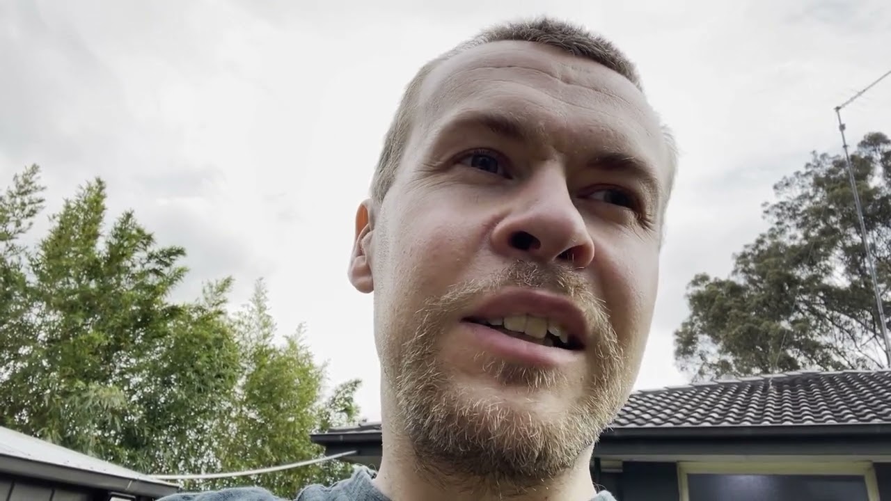 Modified UPPP Surgery - Days 1 to 13 VLOG - UPPP recovery journey following a Double Jaw Surgery