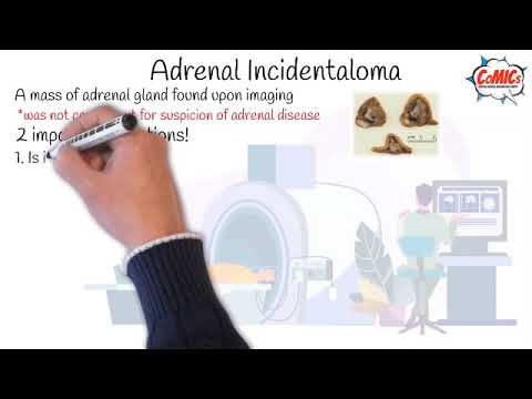 CoMICs Episode 1: Adrenal incidentaloma