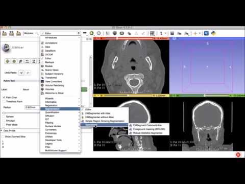 Robust Statistics Segmenter (RSS) Tutorial Video for  Mandibular Segmentation