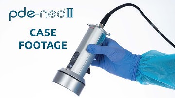 Hamamatsu PDE Neo II NIR ICG Fluorescence Imaging System - Case Footage