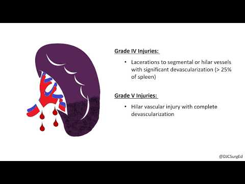 Splenic Injury