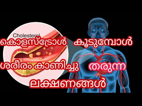 കൊളസ്‌ട്രോൾ കൂടുമ്പോൾ നമുക്ക് ശരീരം കാണിച്ചു തരുന്ന ലക്ഷനങ്ങൾ / High Cholesterol Symptoms