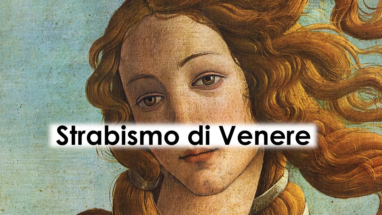 Strabismo di Venere