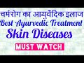     skin diseases    skin diseases cure uttamarogyam