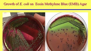 محاضرة الإيشيريشيا كولاي Escherichia coli Lecture