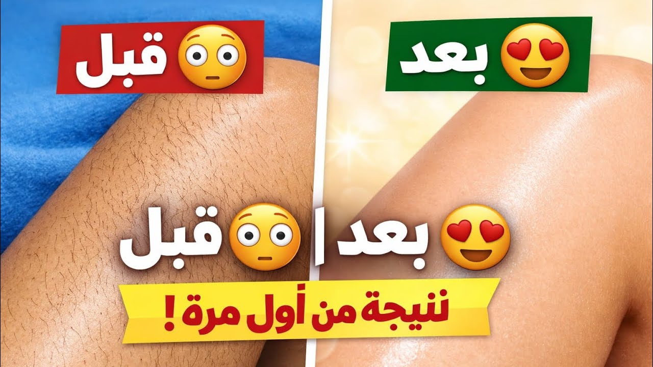 تحدي إزالة الشعر من الجذور بدون ألم💥جربتها واتفاجئت بالنتيجة 😱إزالة شعر الجسم والوجه بديل الليزر 🎁