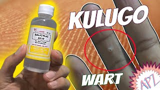 KULUGO SA KAMAY Treatment For Only 20 PESOS? (BEST AND EFFECTIVE) With PROOF KULUGO SA KAMAY Treatment For Only 20 PESOS? (BEST AND EFFECTIVE) With PROOF