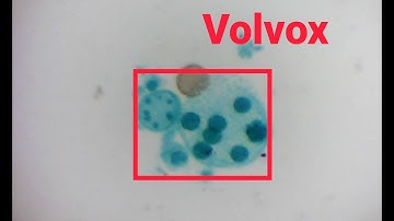Volvox Under Microscope