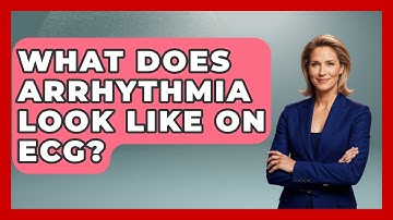 What Does Arrhythmia Look Like on ECG? - Cardiology Community