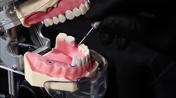 NucleOSS T6 Universal TiBase Casting abutment   Hex