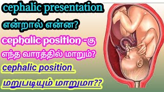 Cephalic position of baby in tamil | Cephalic presentation in tamil |Cephalic position can change|