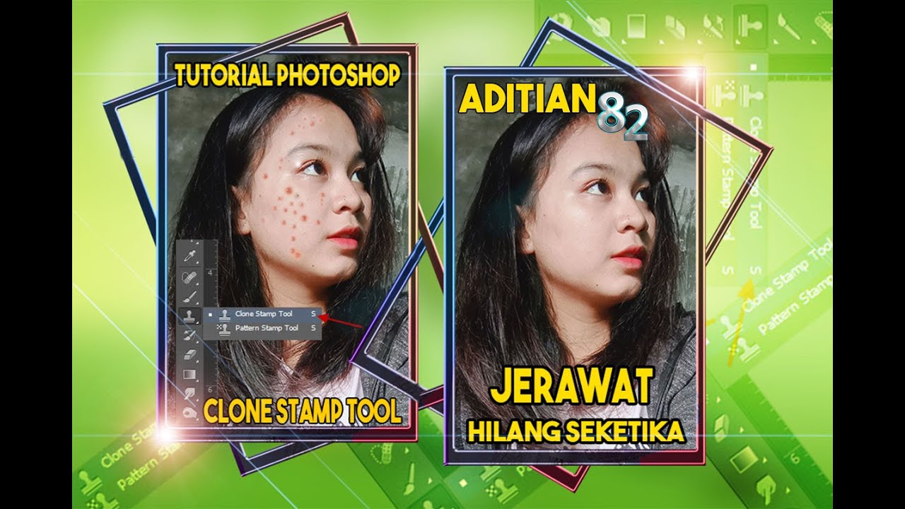 cara menghilangkan jerawat tutorial photoshop 