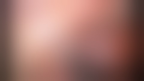 RUL lobectomy with mediastinal lymph node dissection by Dr Pornchai Senarak