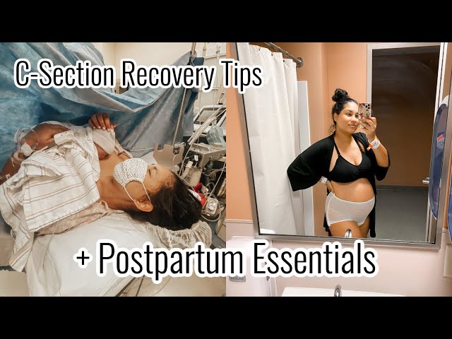 C-Section Recovery Tips + Postpartum Essentials // What I wish I knew 