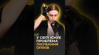 Як вирішують проблему лікування опіків | Громадська наука в Україні під час війни