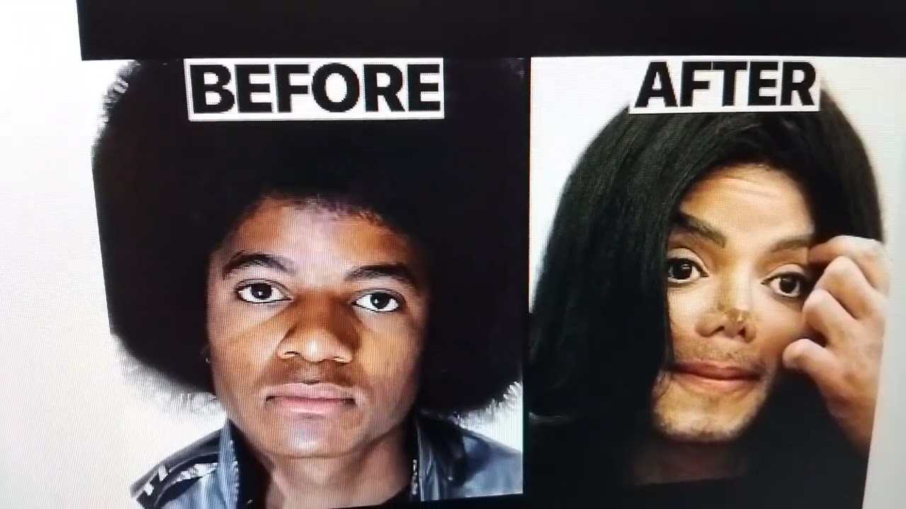 With much money and fame, Michael Jackson lost his nose. But now his gone and no doctor needed, aye?