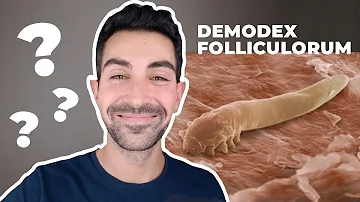 Comment éliminer les Demodex ?