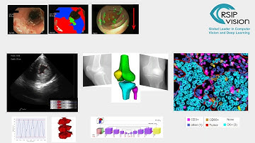 Artificial Intelligence in Medical Imaging - Virtual Meetup by RSIP Vision April 7, 2020