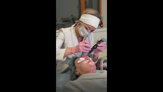 Фракционный лазер Ixtron Fractional — обновление кожи на клеточном уровне! 🔬