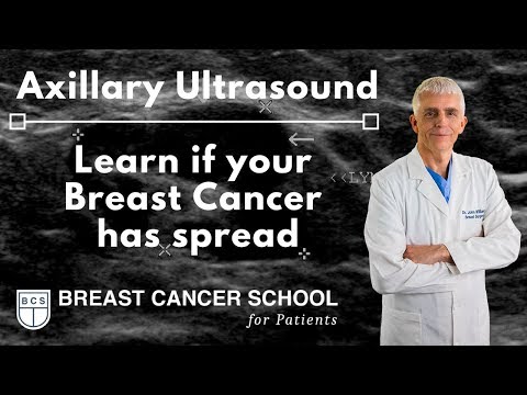 Breast Cancer Axillary Ultrasound: Find involved nodes