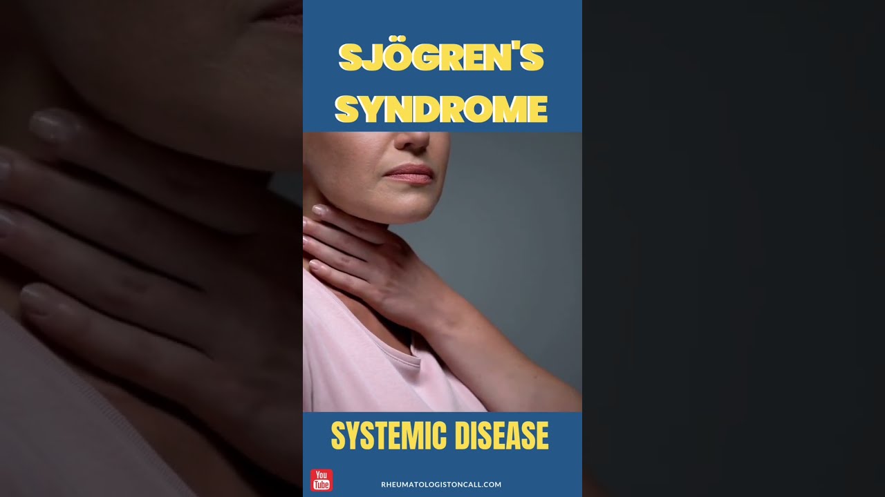 Sjogrens A Systemic Disease Signs And Symptoms Sjogren Autoimmunedisease