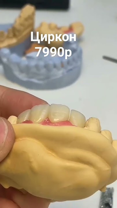 коронка из диоксид циркона всего за 7990р, подробная информация по ...