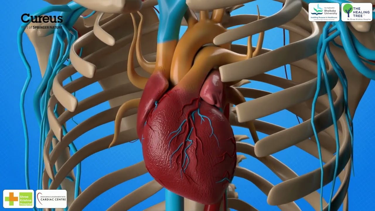 Pulmonary Artery Banding Surgery | Indications, Steps & Hemodynamic Monitoring