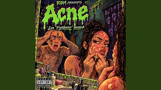 Download Lagu Acne Download Lagu Acne