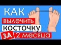 Как избавиться от вальгусной косточки без операции