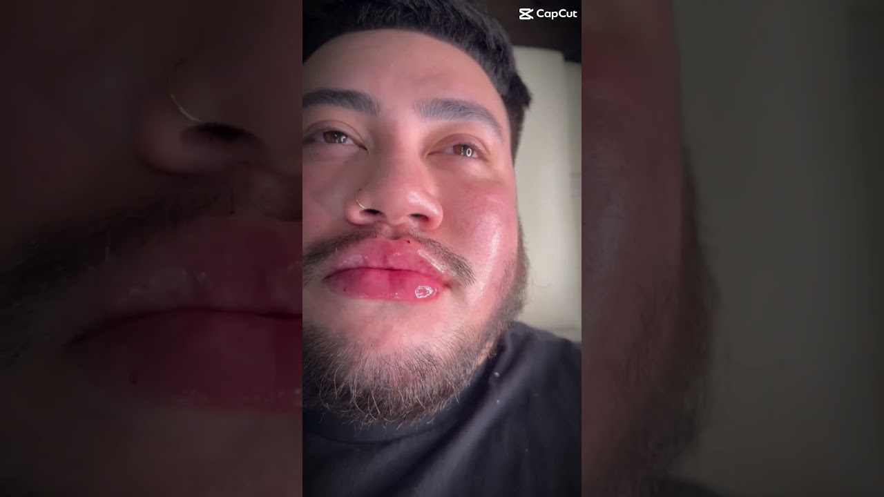 Fresh lips popping!! 