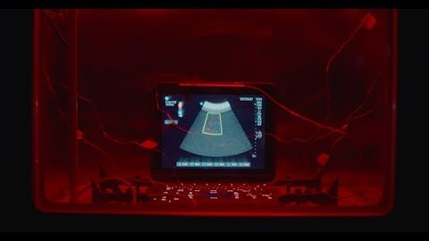 Sonosite: This is Ultrasound Reliability