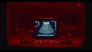 Sonosite: This is Ultrasound Reliability