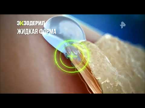 Реклама Экзодерил - Грибок под прицелом (2019) РЕДКИЙ ЭКЗЕМПЛЯР