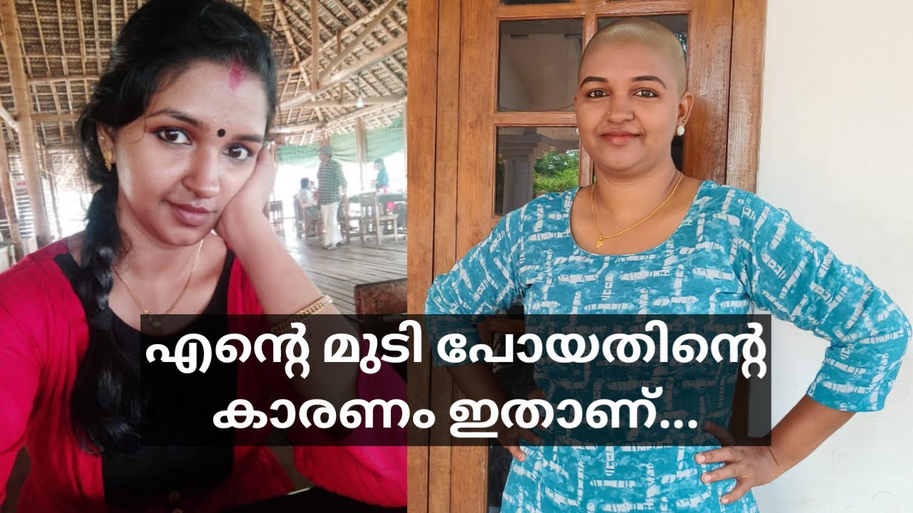 എന്റെ മുടി പോയതിന്റെ കാരണം ഇതാണ്...