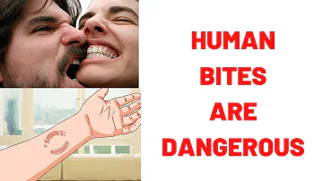 Does a human bite require antibiotics?