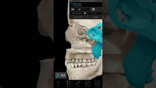 Cavidad Nasal - Paredes Medial Y Lateral - Anatomía