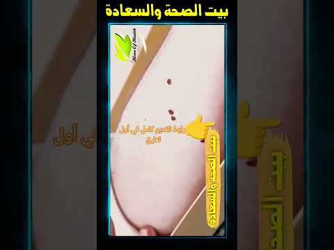 بق الفراش البق بيت الصحة والسعادة