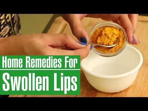 Video: How to Cure Puffy Lips: 15 Steps (with Pictures)