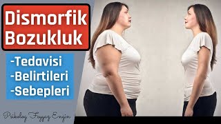 Beden Algısı(Dismorfik) Bozukluğu Tedavisi,Belirtileri,Sebepleri