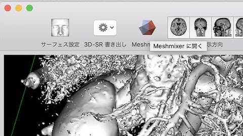 OsiriX & Meshmixer Polygon export: Direct integration of organ polygon models