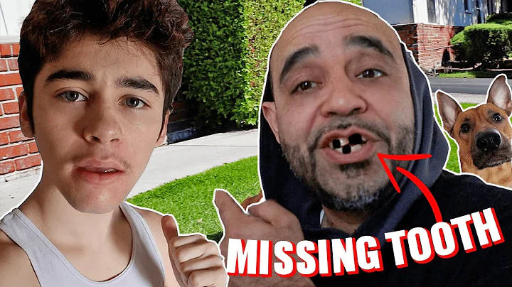 HE KNOCKED HIS TOOTH OUT!!!