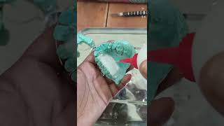 Making Of Removable Orthodontic Appliance