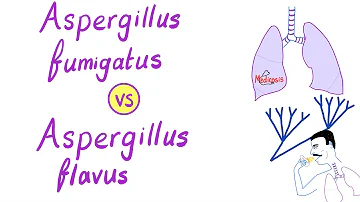 Where is Aspergillus fumigatus found?