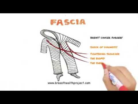 Video: Wat is ontsteking van 'n fascia?