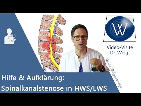 Spinalkanalstenose: Rückenschmerzen durch Spinalstenose in HWS/ LWS ⚡ Symptome, Gefahren & Therapie