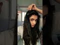 💯Honest review of Hair growth spray |Alopecia areata and hairloss therapy ✅️#haircare #shorts